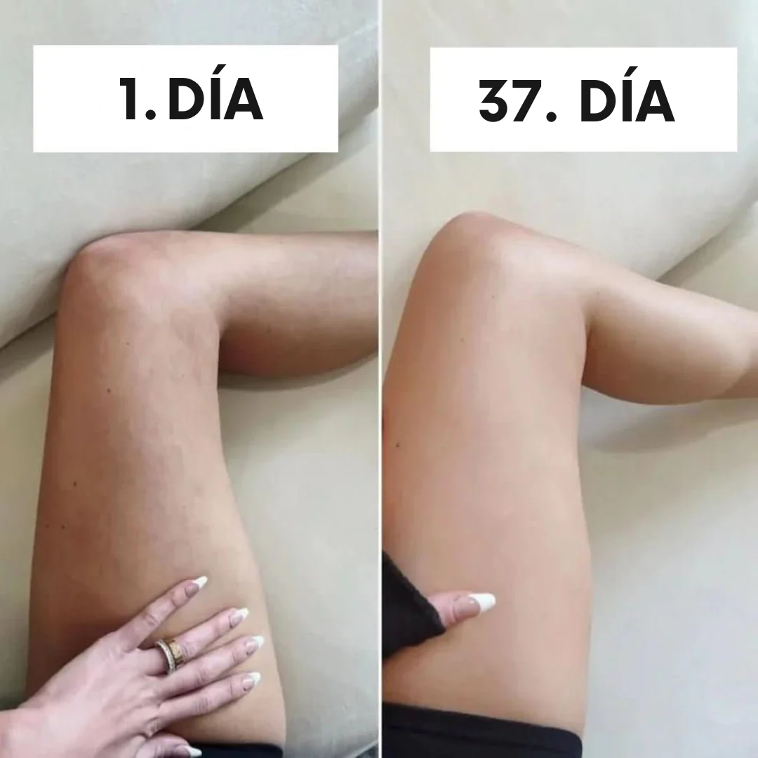 DIVINE™ Masajeador Anticelulitis