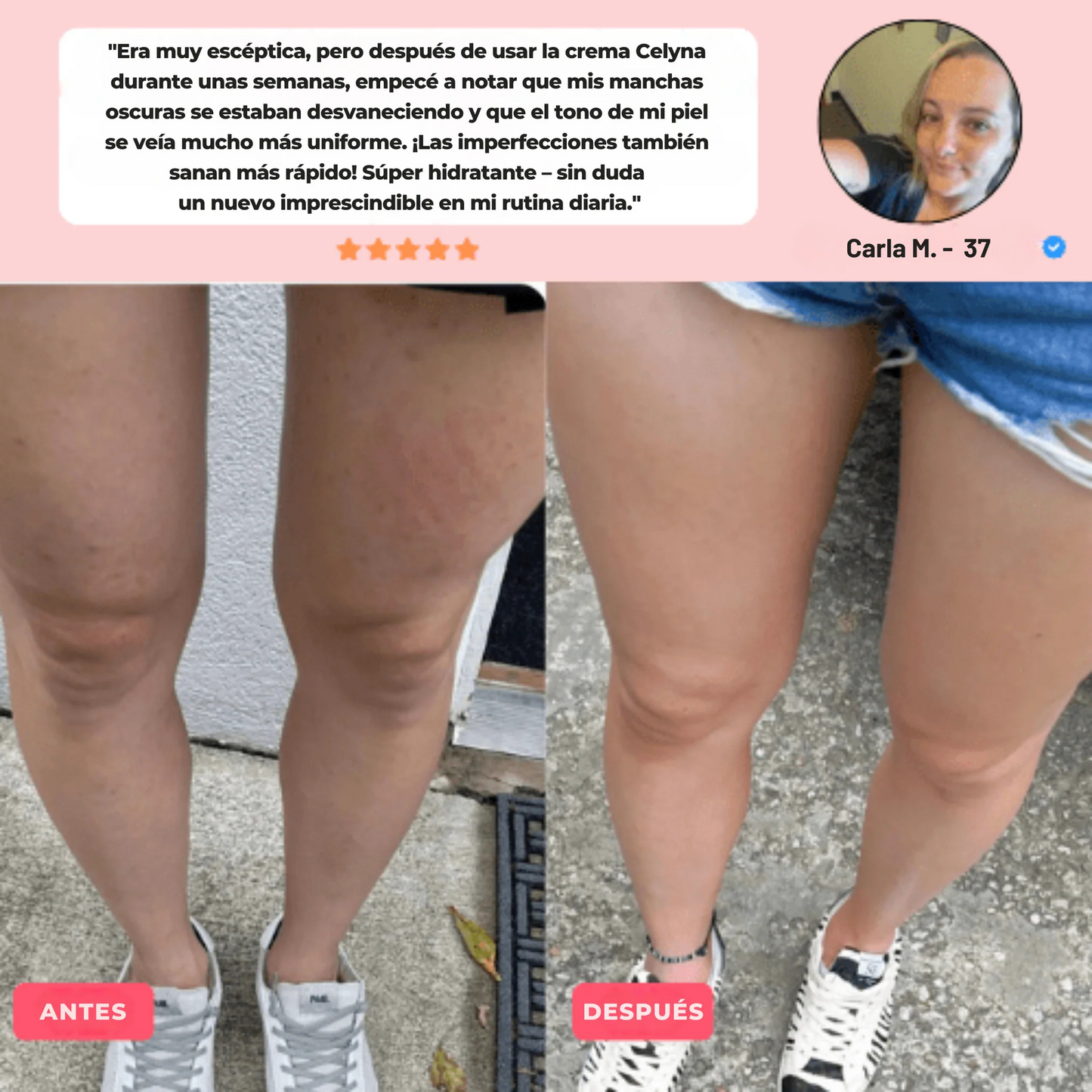 DIVINE™ Masajeador Anticelulitis